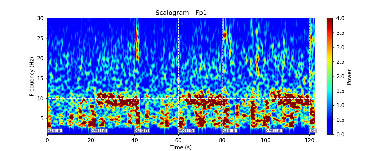 Scalogramme EEG d'un enregistrement réalisé par un de nos devices