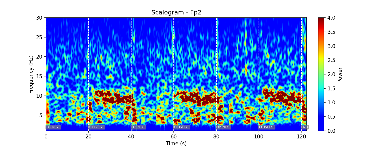 Scalogramme EEG d'un enregistrement réalisé par un de nos devices