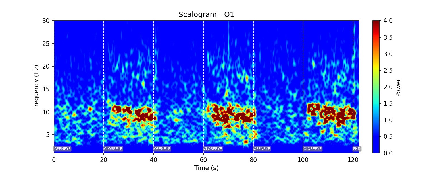 Scalogramme EEG d'un enregistrement réalisé par un de nos devices