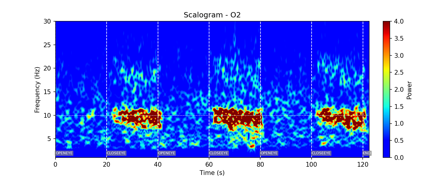 Scalogramme EEG d'un enregistrement réalisé par un de nos devices